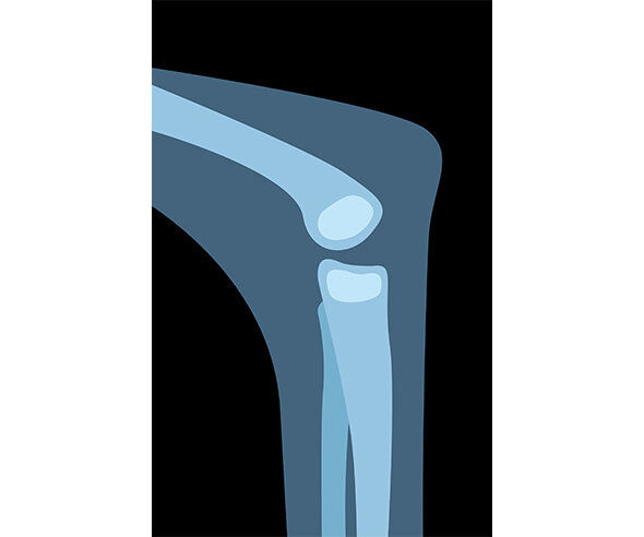 동물 무릎 엑스레이 사진