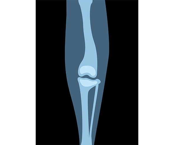 동물 다리 엑스레이 사진