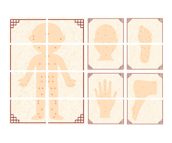한의원 혈자리 포스터 만들기