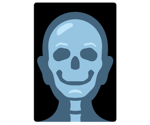 얼굴 엑스레이 사진